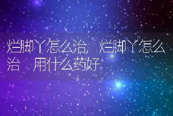 烂脚丫怎么治，烂脚丫怎么治 用什么药好