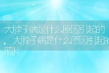 大脖子病是什么原因引起的，大脖子病是什么原因引起的照片