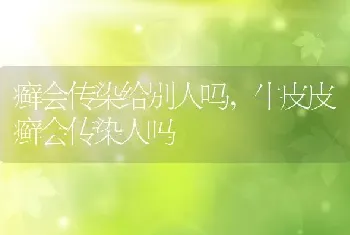 癣会传染给别人吗，牛皮皮癣会传染人吗