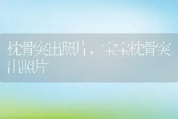 枕骨突出照片，宝宝枕骨突出照片