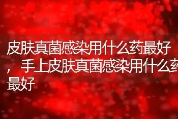 皮肤真菌感染用什么药最好，手上皮肤真菌感染用什么药最好