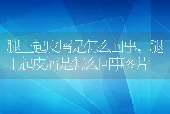 腿上起皮屑是怎么回事，腿上起皮屑是怎么回事图片